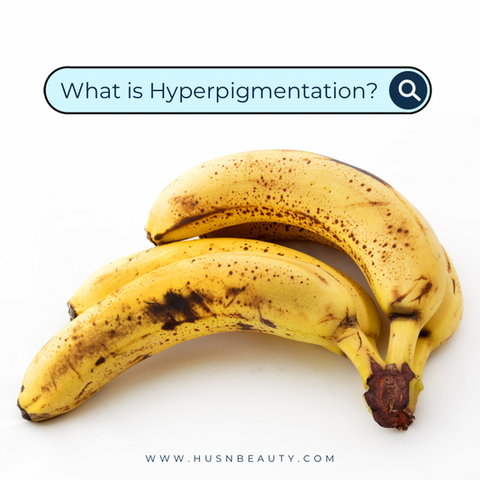 What is Hyperpigmentation?